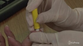 Aids, nuove speranze dalla ricerca italiana