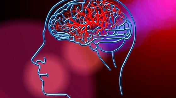 Ictus, il tempo fattore determinante per salvare i pazienti