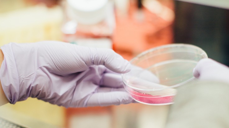 Meno effetti collaterali e una buona risposta immunitaria: è la chemio a basse dosi