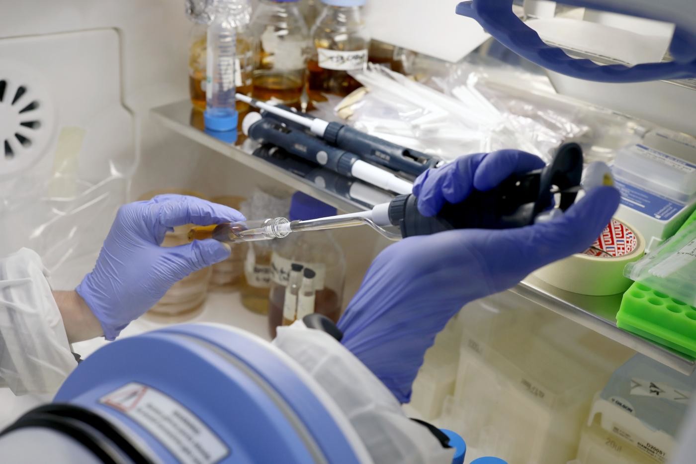 Domenica la Giornata dell’Epatite C: la cura c’è, si lavora all’eliminazione del virus