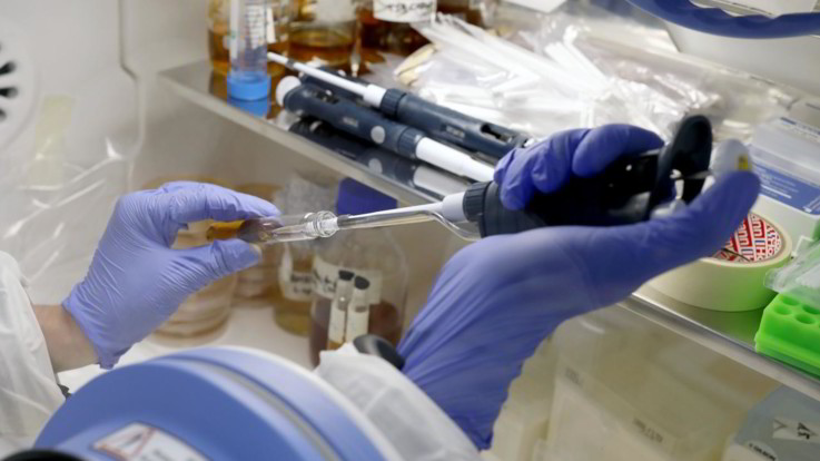 Domenica la Giornata dell'Epatite C: la cura c'è, si lavora all'eliminazione del virus
