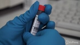 Messina, nasconde di avere l’Aids: la ex compagna muore