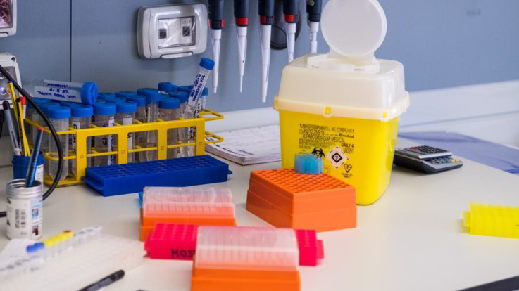 Un nuovo test per il cancro alla prostata potrebbe sostituire la biopsia