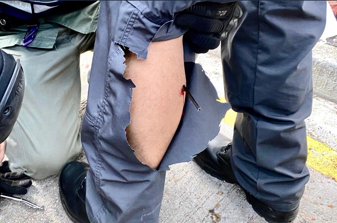 Scontri Hong Kong, agente di polizia colpito da una freccia