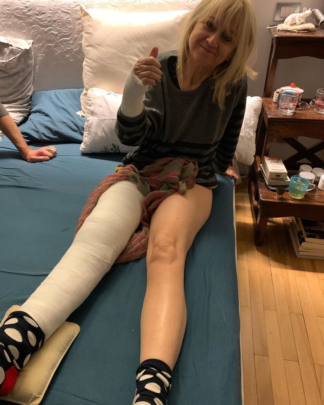 Capodanno… ingessato per Luciana Littizzetto: frattura di rotula e polso