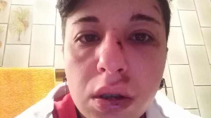 Potenza: picchiata da sconosciuti perché lesbica, la foto-denuncia su Fb