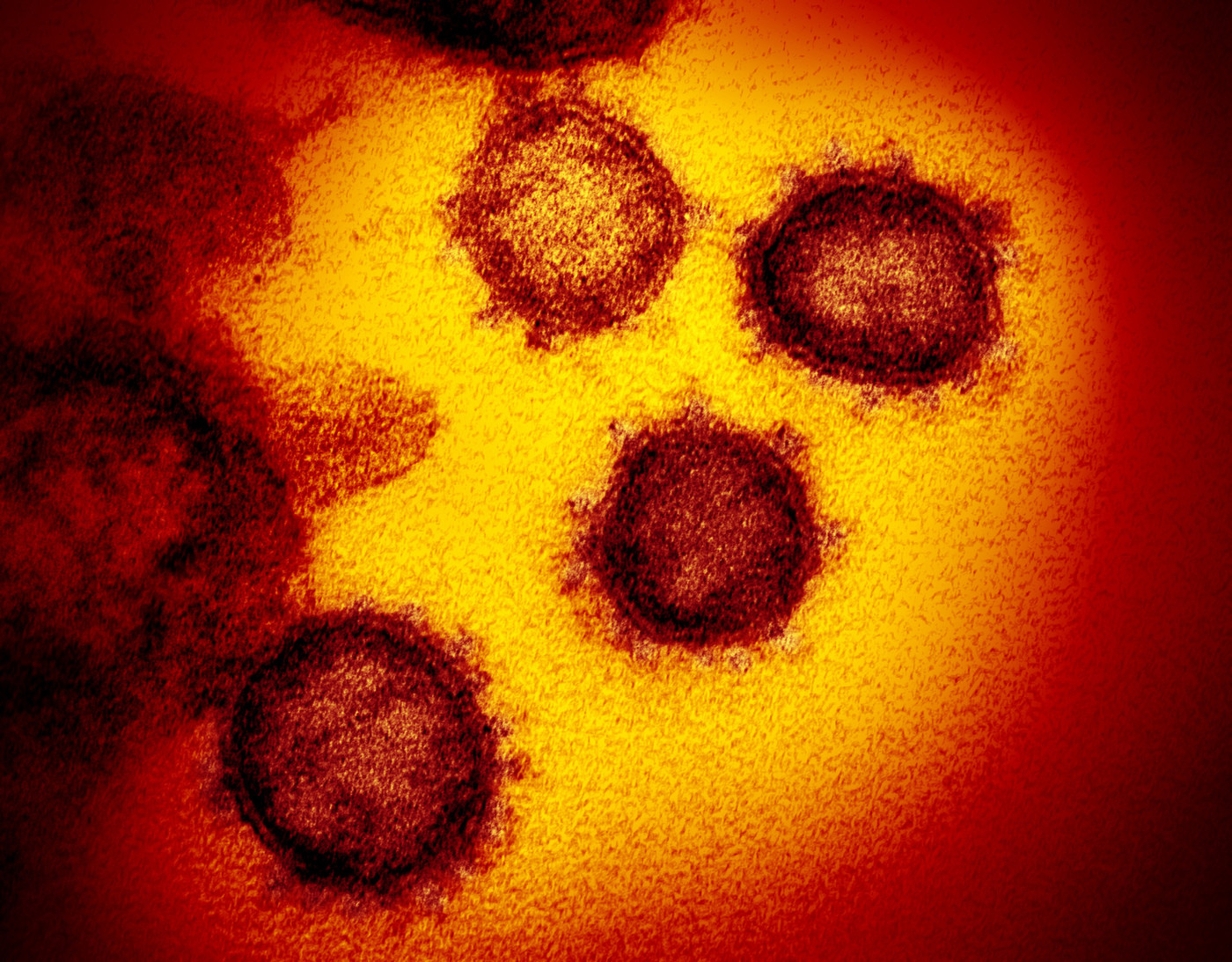 Coronavirus, sul picco della pandemia regna incertezza e confusione – Analisi