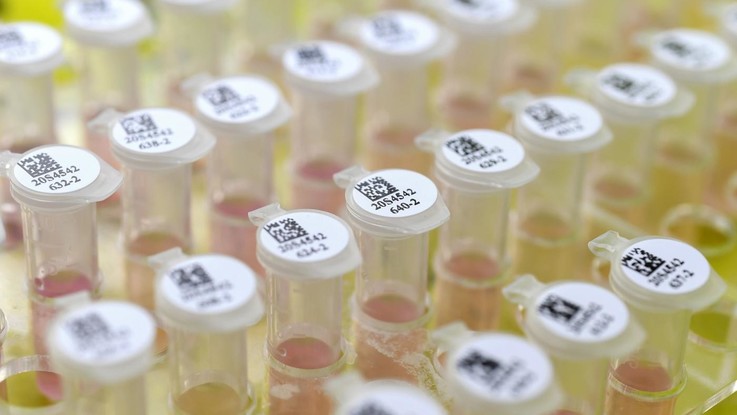Coronavirus, in Toscana test solo ai sospetti