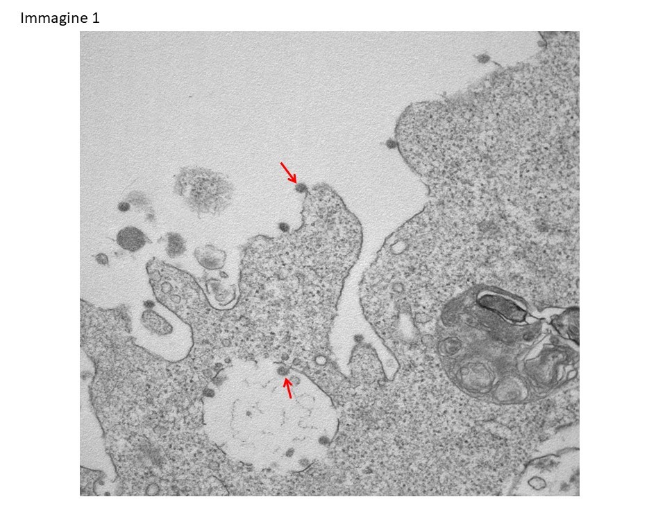 Coronavirus, le prime immagini al microscopio del Sars-CoV-2 isolato all’ospedale Sacco