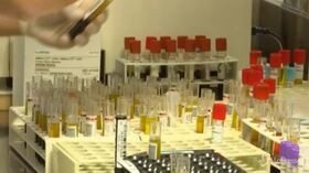 Coronavirus, Brusaferro: “Nuova ondata in autunno”