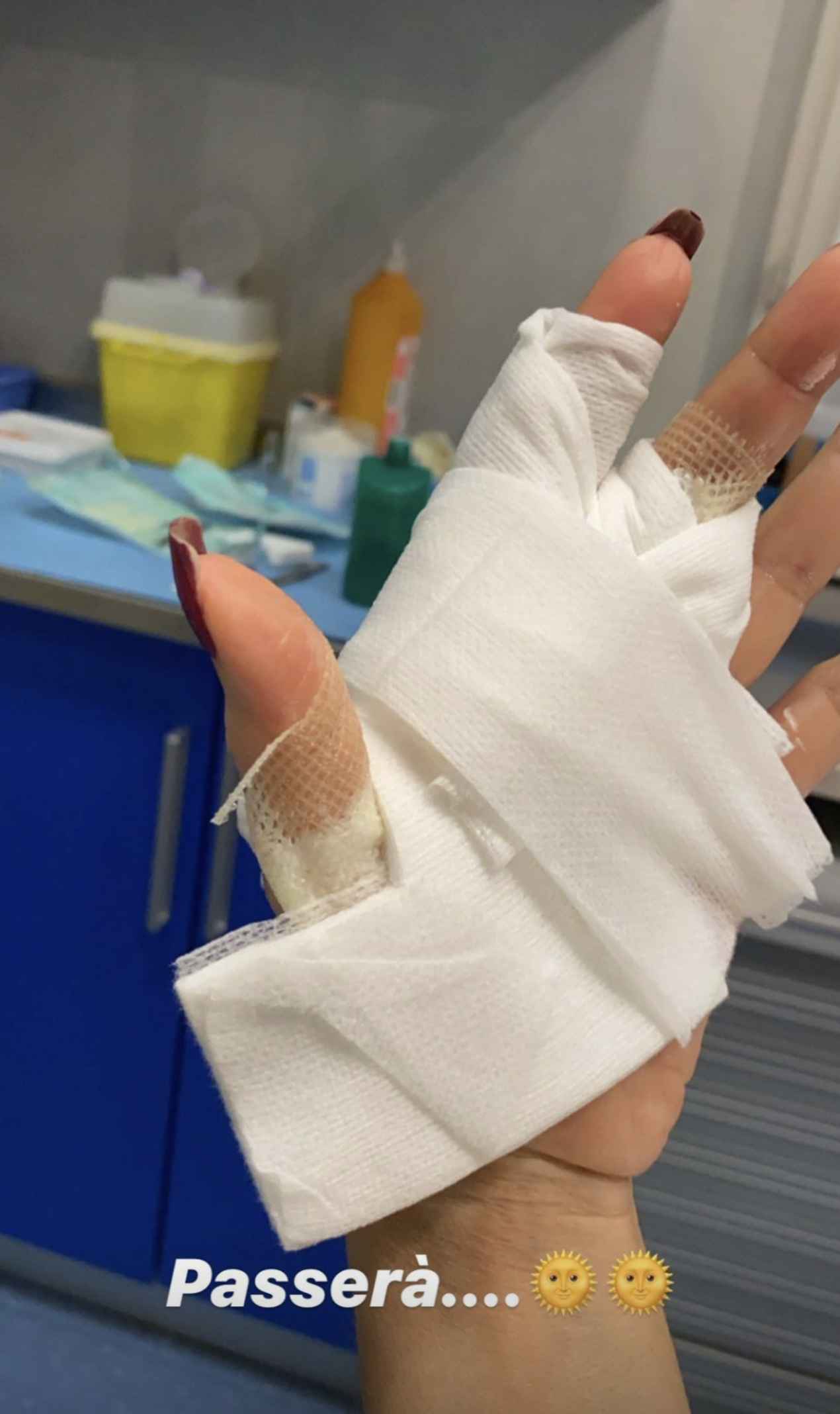 Incidente per Barbara D’Urso: “Ho un’ustione” – VIDEO