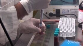 Coronavirus: positivo in 3 minuti, ecco il tampone rapido ideato da ricercatori napoletani