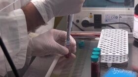 Coronavirus, frenano i contagi in Italia