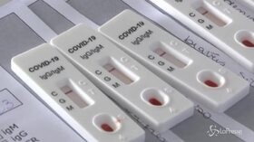 Coronavirus, Cts lavora a nuovi test rapidi