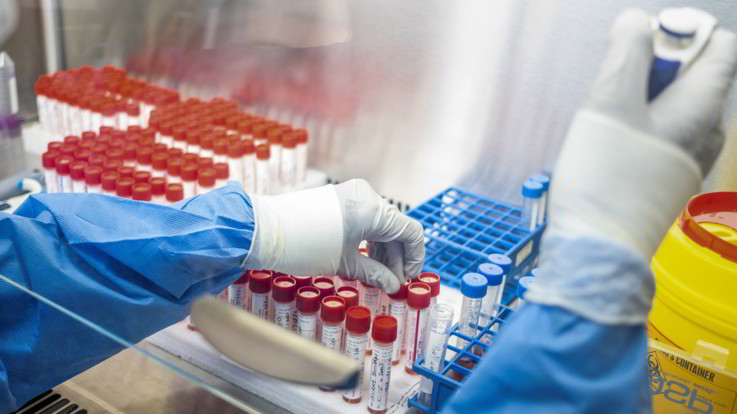 Coronavirus, 1733 casi su oltre 133mila tamponi e 11 morti