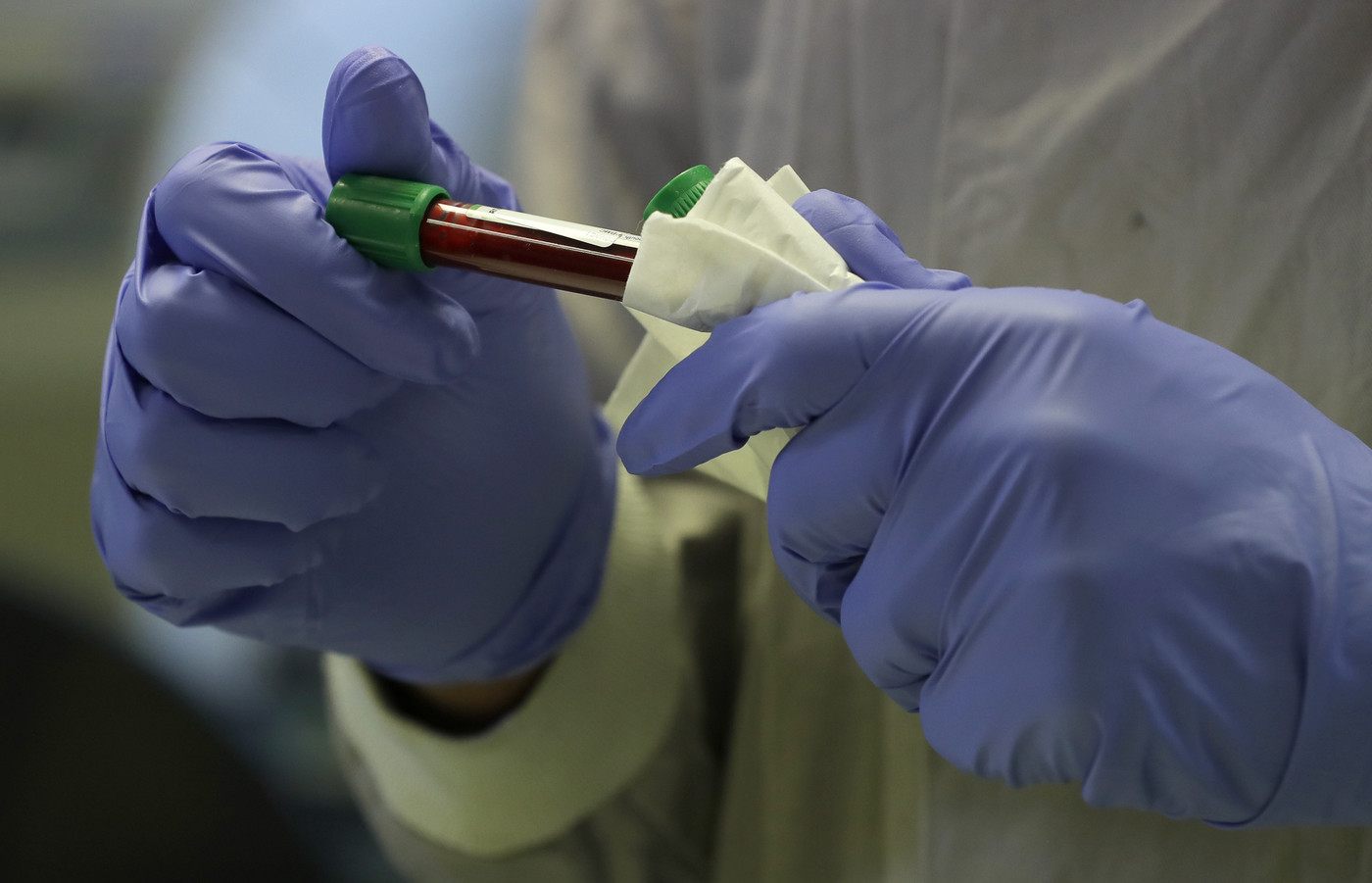 Coronavirus, in Veneto al via la sperimentazione del vaccino