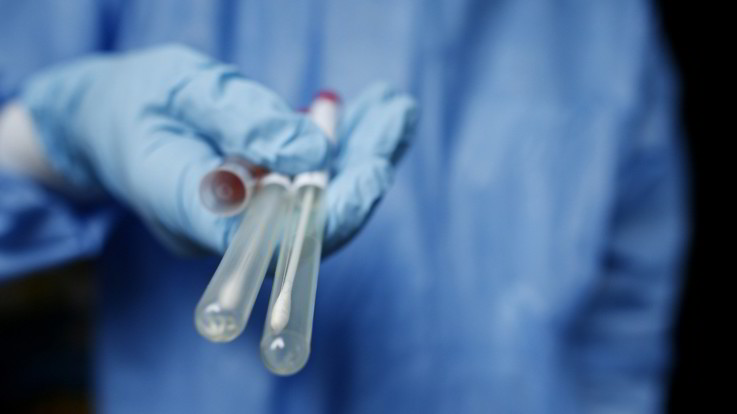 Dalla Brianza arriva il test rapido: risultato in 3 minuti