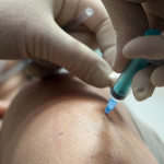 Coronavirus, virologa Stefanelli: “Vaccini funzioneranno lo stesso”