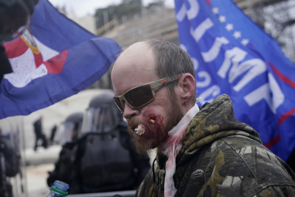 Galleria foto 'I manifestanti trumpisti assediano Capitol Hill | FOTOGALLERY' - foto 3