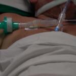 Covid, in Brasile mancano i sedativi: pazienti intubati da svegli e legati