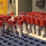 Covid, cure a domicilio con terapie monoclonali. Asl Napoli 3 Sud: “Così evitiamo ospedalizzazioni”