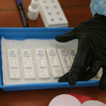 Covid, presidente Società Italiana Virologia: “I tamponi rapidi possono arrivare al 30% di falsi negativi”