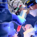 Usa, primo trapianto di cuore da maiale geneticamente modificato a paziente 57enne