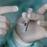 Covid, Omicron diffusa all’81% in Italia. Delta è al 19%