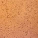 Vaiolo scimmie: in Italia 5 mln di vaccini ma la campagna ora non serve. Speranza: “No allarmismi”