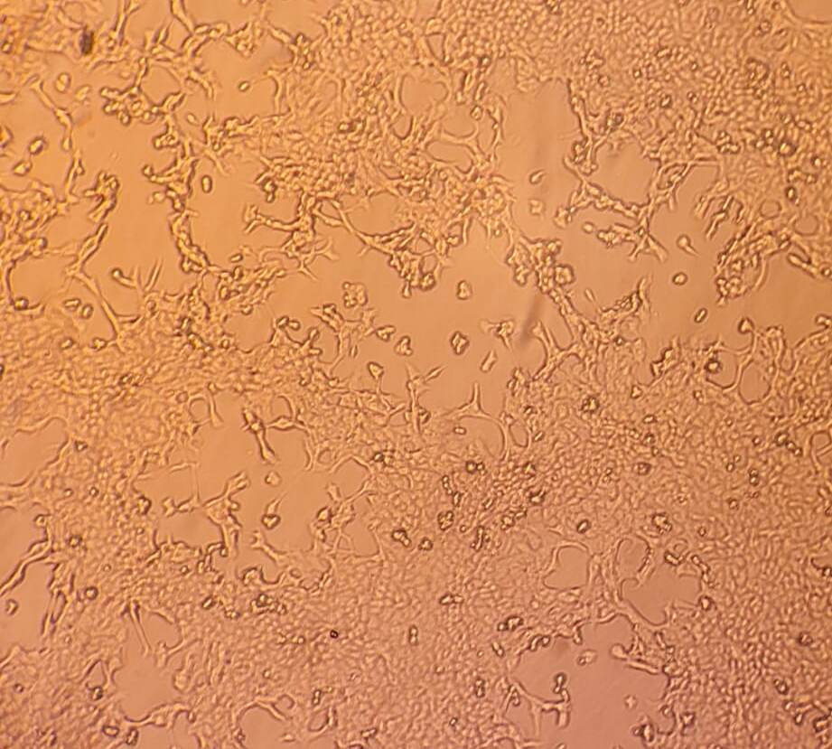 Vaiolo scimmie: in Italia 5 mln di vaccini ma la campagna ora non serve. Speranza: “No allarmismi”