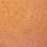 Vaiolo scimmie, Ema: “Casi saliranno, ma nessuna emergenza sanitaria”