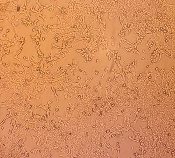 Vaiolo delle scimmie, sequenziato il genoma completo del virus al San Matteo di Pavia