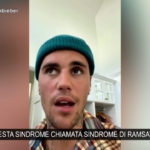 Justin Bieber su Instagram: “Ho una paralisi facciale, prenderò una pausa”