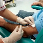 Vaiolo delle scimmie, Vaia: “Grande partecipazione al primo giorno di vaccinazioni”