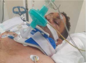 Roma, giù da finestra durante perquisizione: disabile in coma