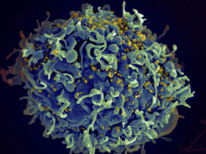 Global Fund gets powerful help with $18 billion funding goal
