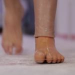 Siria, la ong indiana costruisce protesi per i reduci della guerra