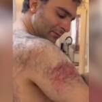 Iran, Ashkzari mostrava in video segni torture