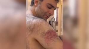 Iran, Ashkzari mostrava in video segni torture