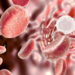Leucemia mielomonocitica cronica, cos’è la malattia di Berlusconi