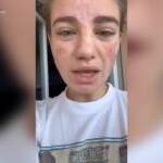 Rubano borsa a Bebe Vio: “Ridatemi la tesi, devo consegnarla”