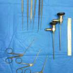 Torino, intervento unico al mondo per salvare neonato