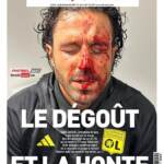 Calcio, Grosso sanguinante su prima pagina L’Equipe: ‘il disgusto e la vergogna’