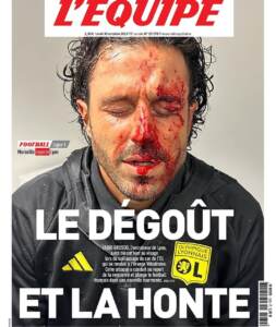 Calcio, Grosso sanguinante su prima pagina L’Equipe: ‘il disgusto e la vergogna’