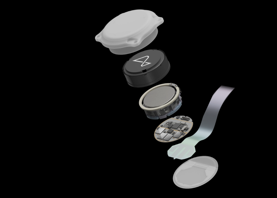 Neuralink, Musk annuncia: paziente con chip controlla mouse col pensiero