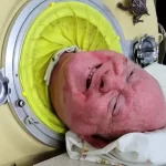 Paul Alexander, morto l’uomo vissuto 70 anni nel “polmone d’acciaio”