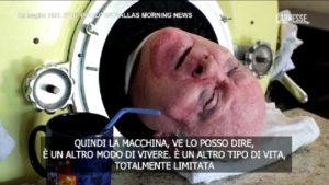 Paul Alexander, una vita nel polmone d’acciaio: “Molti impazzirebbero”