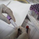 Dengue, cos’è la febbre tropicale che spaventa anche l’Italia