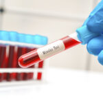 Morbillo, crescono in casi in Italia: nel 2024 sono già oltre 200