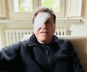 Gianni Morandi su Instagram con una benda sull’occhio: fan preoccupati, l’ironia del cantante
